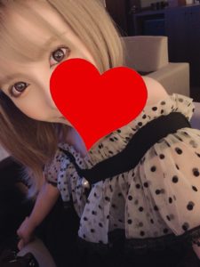 FX トレード精度について